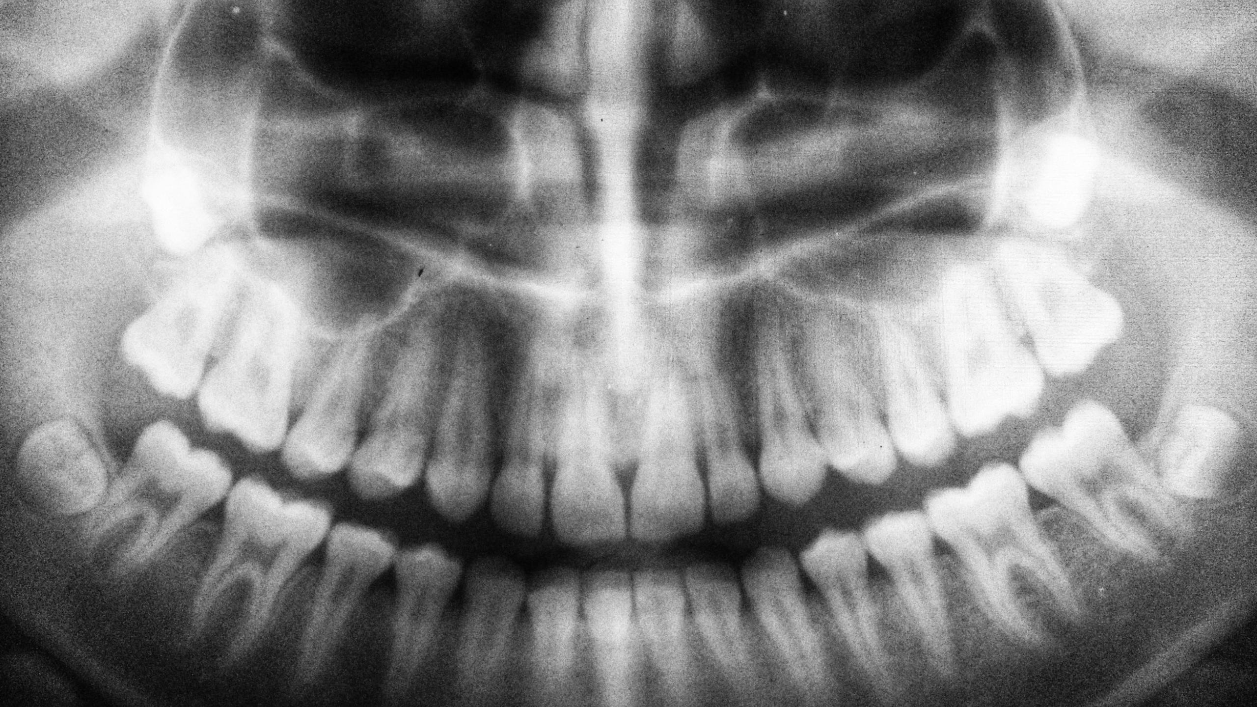 AspiringDental Wanaka Dentist X ray umanoide KeVKEs1 RDU unsplash